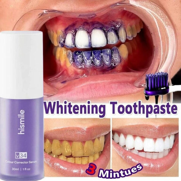 Hismile V34 Teeth Color Corrector Serum 30ml | Teeth Brightener
